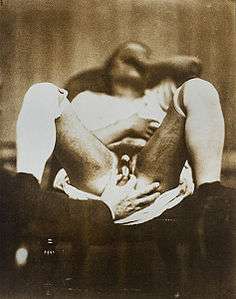 Hermaphrodite by Nadar 6.jpg