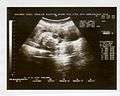 Ultrasound Scan ND 083.jpg